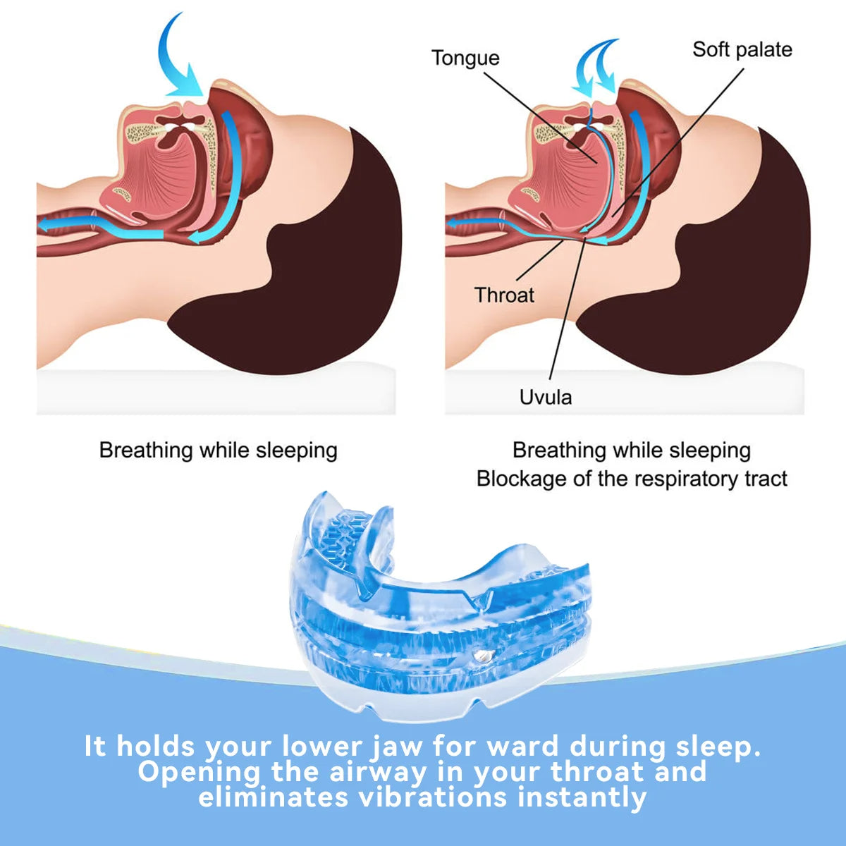 Adjustable Anti Snore Mouthpiece
